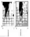 Fig. 46 - Focused microarray and methods of diagnosing chemotherapeutic drug resistance in a cancer cell