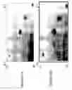 Fig. 57 - Focused microarray and methods of diagnosing chemotherapeutic drug resistance in a cancer cell