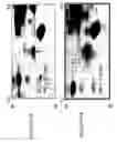 Fig. 63 - Focused microarray and methods of diagnosing chemotherapeutic drug resistance in a cancer cell