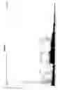 Fig. 04 - Complement C3 precursor biopolymer markers predictive of type II diabetes