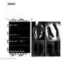 Fig. 16 - Antibodies for identification of murine fragilis extracellular domain and methods for identifying pluripotent cells