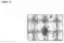 Fig. 11 - Assay method and apparatus with reduced sample matrix effects