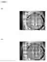 Fig. 12 - Assay method and apparatus with reduced sample matrix effects