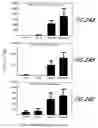 Fig. 48 - HIV vaccines based on Env of multiple clades of HIV