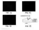 Fig. 02 - Methods for in vitro expansion and transdifferentiation of human pancreatic acinar cells into insulin-producing cells