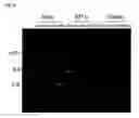 Fig. 11 - Method for introducing a gene into 