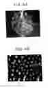 Fig. 07 - Light-controlled electrokinetic assembly of particles near surfaces