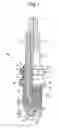 Fig. 02 - Method for securing a metal noble tip to an electrode of a spark plug using a resistance and laser welding process