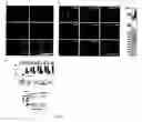 Fig. 02 - Increasing functional glycosylation of alpha-dystroglycan in the treatment of muscle degeneration