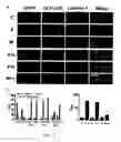 Fig. 06 - Increasing functional glycosylation of alpha-dystroglycan in the treatment of muscle degeneration