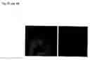 Fig. 03 - Agonist polypeptide of receptor for ZOT and zonulin