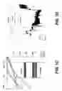 Fig. 03 - Methods for treating brain swelling with a compound that blocks a non-selective cation channel