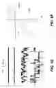 Fig. 04 - Methods for treating brain swelling with a compound that blocks a non-selective cation channel