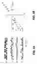Fig. 06 - Methods for treating brain swelling with a compound that blocks a non-selective cation channel