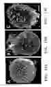 Fig. 20 - Methods for treating brain swelling with a compound that blocks a non-selective cation channel