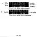 Fig. 25 - Methods for treating brain swelling with a compound that blocks a non-selective cation channel