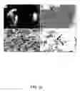 Fig. 27 - Methods for treating brain swelling with a compound that blocks a non-selective cation channel