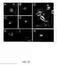 Fig. 28 - Methods for treating brain swelling with a compound that blocks a non-selective cation channel
