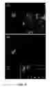 Fig. 29 - Methods for treating brain swelling with a compound that blocks a non-selective cation channel