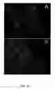 Fig. 31 - Methods for treating brain swelling with a compound that blocks a non-selective cation channel