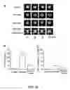 Fig. 35 - Methods for treating brain swelling with a compound that blocks a non-selective cation channel