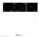 Fig. 48 - Methods for treating brain swelling with a compound that blocks a non-selective cation channel
