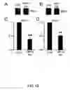 Fig. 49 - Methods for treating brain swelling with a compound that blocks a non-selective cation channel