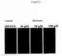 Fig. 64 - Methods and compositions for treating flushing and drug induced weight gain