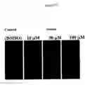 Fig. 65 - Methods and compositions for treating flushing and drug induced weight gain