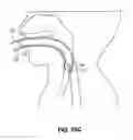 Fig. 29 - Methods and devices for non-invasive cerebral and systemic cooling