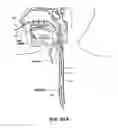 Fig. 35 - Methods and devices for non-invasive cerebral and systemic cooling
