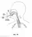 Fig. 40 - Methods and devices for non-invasive cerebral and systemic cooling