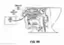 Fig. 53 - Methods and devices for non-invasive cerebral and systemic cooling
