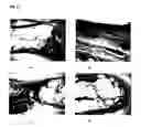 Fig. 11 - Composite materials for bone defect filling and bone replacement