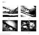 Fig. 12 - Composite materials for bone defect filling and bone replacement