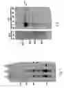 Fig. 04 - Hyaluronate synthase gene and uses thereof