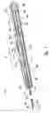 Fig. 05 - Apparatuses and methods for percutaneously implanting objects in patients