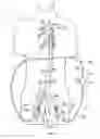 Fig. 01 - Cannulae having a redirecting tip