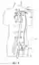 Fig. 05 - Cannulae having a redirecting tip
