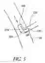 Fig. 06 - Cannulae having a redirecting tip