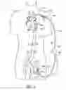 Fig. 07 - Cannulae having a redirecting tip