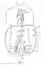 Fig. 08 - Cannulae having a redirecting tip