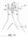 Fig. 16 - Cannulae having a redirecting tip
