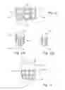 Fig. 09 - In-vivo method and device for improving diastolic function of the left ventricle