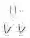 Fig. 10 - In-vivo method and device for improving diastolic function of the left ventricle