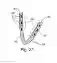 Fig. 13 - In-vivo method and device for improving diastolic function of the left ventricle