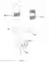 Fig. 19 - In-vivo method and device for improving diastolic function of the left ventricle