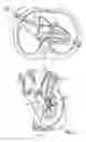 Fig. 02 - Device and method for treating congestive heart failure