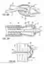 Fig. 06 - Device and method for treating congestive heart failure