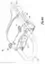 Fig. 11 - Multi-fluid delivery system